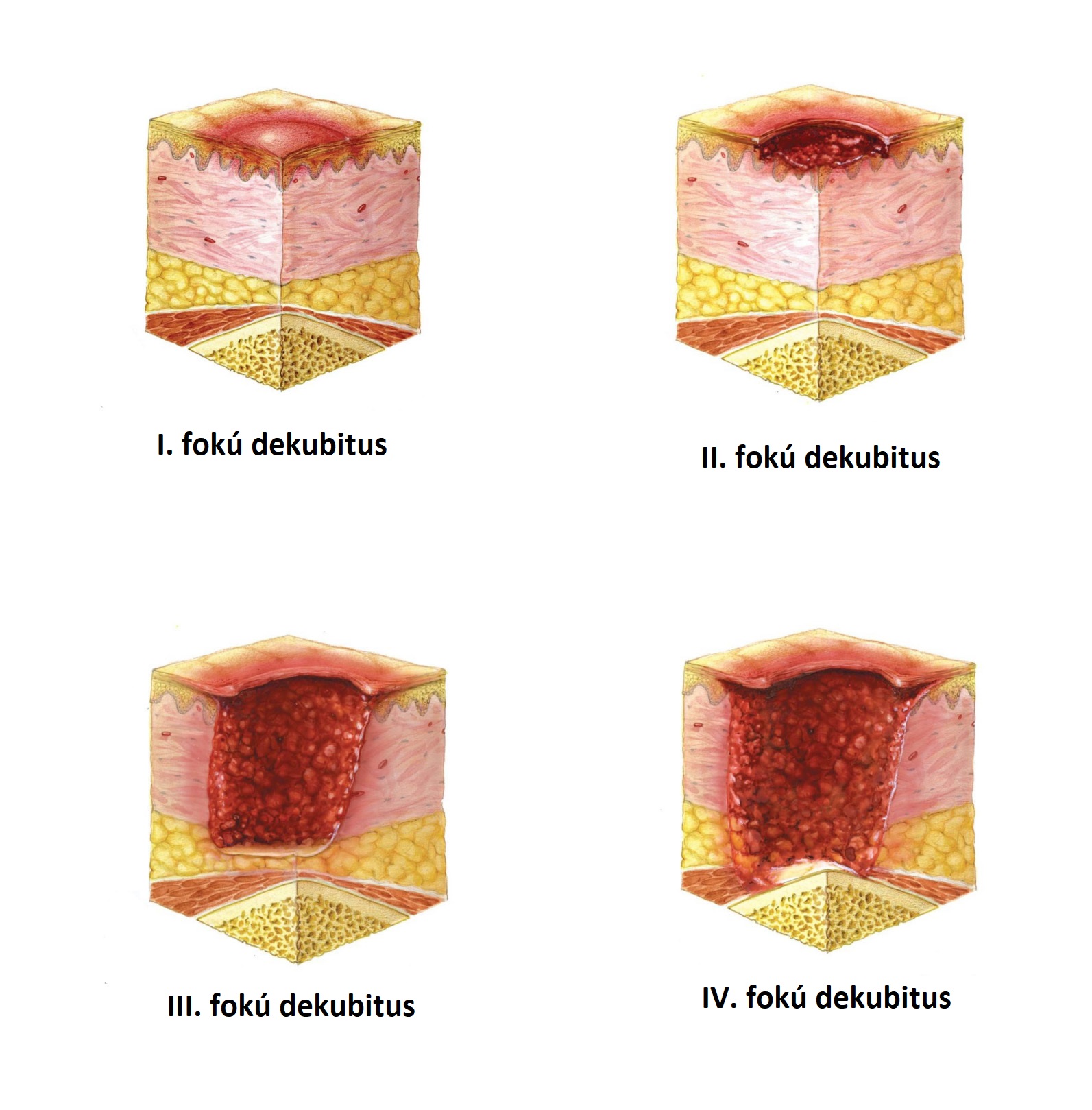 Antidecubitus matrac  kompresszorral UNIZDRAV