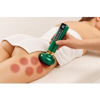 Elektromos köpölyöző készülék narancsbőr ellen