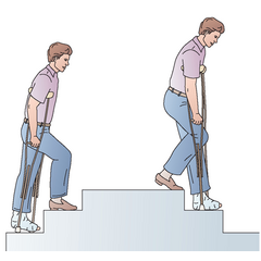 Fa hónaljmankó - extra nagy (132 cm - 146 cm)