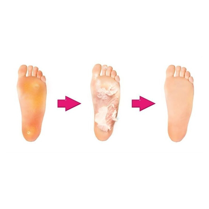 Hámlasztó zokni durva bőrre